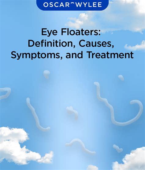 Last Updated February 15, 2022. . My eye floaters disappeared forum